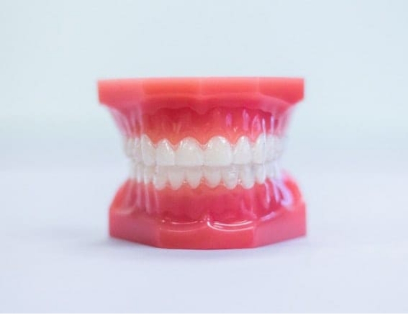 Clear Aligners Mold