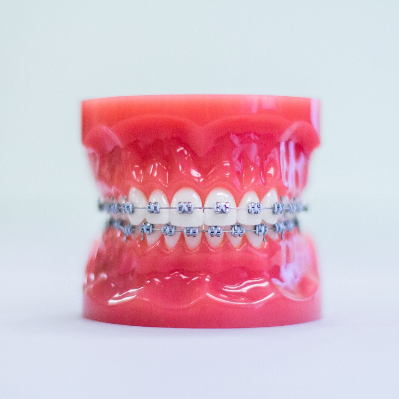 Orthodontic Treatment