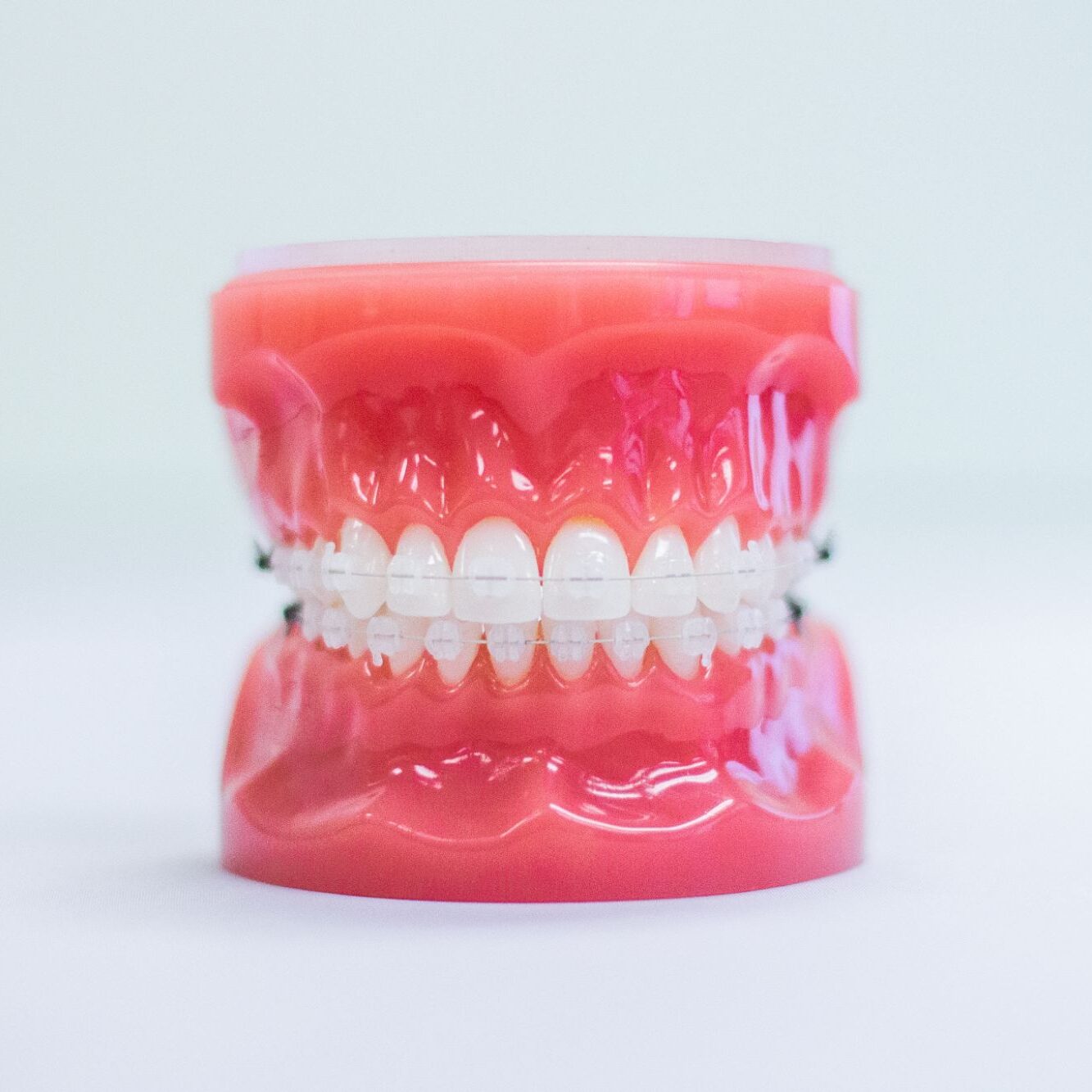 Orthodontic Treatment