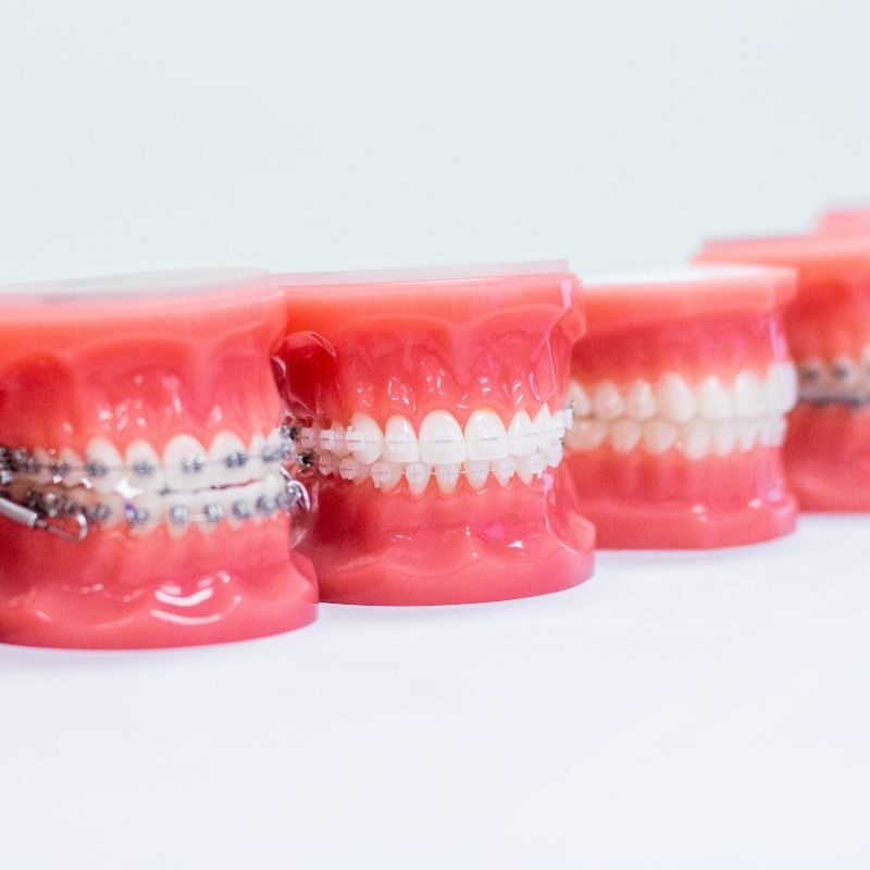 Retreatment Options for Adults